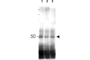 Western blot using MER2 polyclonal antibody  shows detection of phosphorylated and unphosphorylated MER2 in wild type, phosphatase treated and mutant cells.