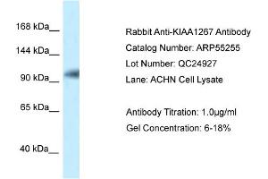 Western Blotting (WB) image for anti-KAT8 Regulatory NSL Complex Subunit 1 (KANSL1) (N-Term) antibody (ABIN970994) (KANSL1 Antikörper  (N-Term))