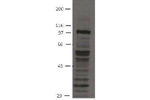 Image no. 1 for anti-Fibroblast Growth Factor Receptor 4 (FGFR4) (Cytoplasmic Domain) antibody (ABIN1169685)