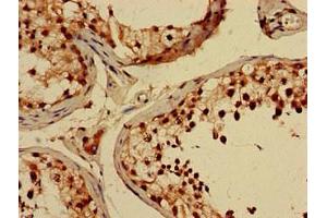 Immunohistochemistry of paraffin-embedded human testis tissue using ABIN7148821 at dilution of 1:100 (CREB3L4 Antikörper  (AA 13-133))