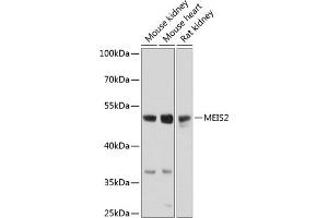 Western blot analysis of extracts of various cell lines, using MEIS2 antibody (ABIN6128272, ABIN6143723, ABIN6143724 and ABIN6224498) at 1:1000 dilution. (MEIS2 Antikörper  (AA 351-470))