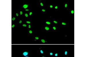 Immunofluorescence analysis of A549 cells using RUVBL1 Polyclonal Antibody (RUVBL1 Antikörper)