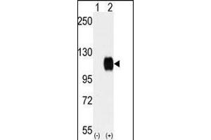 Western blot analysis of SKY (arrow) using rabbit polyclonal SKY Antibody (C-term) (ABIN392054 and ABIN2841821).
