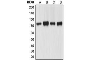 Western blot analysis of MLH1 expression in KNRK (A), HeLa (B), A431 (C), SW480 (D) whole cell lysates. (MLH1 Antikörper  (Center))