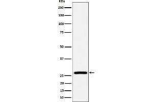 Western blot analysis of AK2 expression in HepG2 cell lysate.