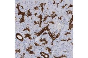 Immunohistochemical staining of human pancreas with EXOC2 polyclonal antibody  shows strong cytoplasmic and membranous positivity in intercalated ducts at 1:2500-1:5000 dilution. (EXOC2 Antikörper)