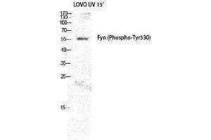 Western Blotting (WB) image for anti-FYN Oncogene Related To SRC, FGR, YES (FYN) (pTyr530) antibody (ABIN3179641) (FYN Antikörper  (pTyr530))