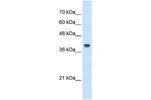 IFI44L antibody used at 5 ug/ml to detect target protein. (IFI44L Antikörper  (N-Term))