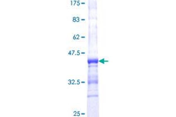 Cytohesin 2 Protein (CYTH2) (AA 314-398) (GST tag)