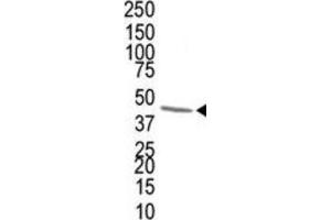 Western Blotting (WB) image for anti-Farnesyl Diphosphate Synthase (FDPS) antibody (ABIN3001523) (FDPS Antikörper)