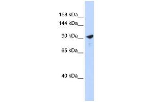 WB Suggested Anti-PAPPA2 Antibody Titration:  0. (PAPPA2 Antikörper  (Middle Region))