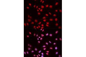 Immunofluorescence analysis of MCF-7 cells using Phospho-ELK1-S383 antibody (ABIN5969890). (ELK1 Antikörper  (pSer383))