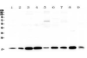 Western blot analysis of LIF using anti-LIF antibody . (LIF Antikörper  (AA 24-203))