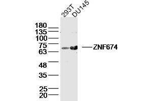 Lane 1: 293T lysates Lane 2: DU145 lysates probed with ZNF674 Polyclonal Antibody, Unconjugated  at 1:300 dilution and 4˚C overnight incubation. (ZNF674 Antikörper  (AA 301-400))