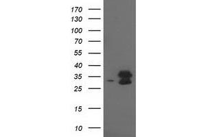 Western Blotting (WB) image for anti-Eukaryotic Translation Initiation Factor 4E Family Member 2 (EIF4E2) antibody (ABIN1497992) (EIF4E2 Antikörper)