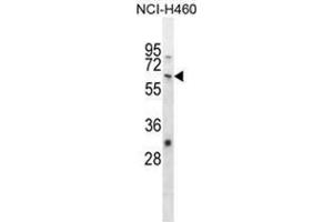 WHSC2 Antibody (Center) western blot analysis in NCI-H460 cell line lysates (35 µg/lane). (WHSC2 Antikörper  (Middle Region))