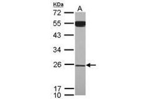 Image no. 1 for anti-YEATS Domain Containing 4 (AA 1-203) antibody (ABIN1501789) (GAS41 Antikörper  (AA 1-203))