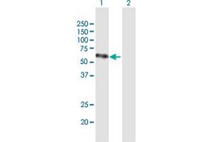 Western Blot analysis of VEGFC expression in transfected 293T cell line by VEGFC MaxPab polyclonal antibody. (VEGFC Antikörper  (AA 1-419))