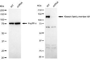 Western blotting analysis using kinesin family member 4A antibody (ABIN7799207). (Rekombinanter KIF4A Antikörper)