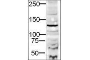 Image no. 1 for anti-Diaphanous Homolog 2 (DIAPH2) (AA 1085-1101) antibody (ABIN199948)