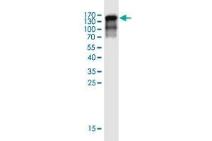 Western Blot detection against Immunogen (120. (FAM35A Antikörper  (AA 1-835))