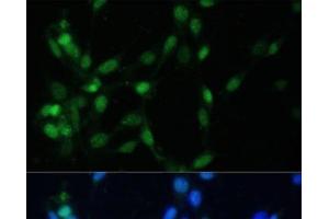 Immunofluorescence analysis of NIH-3T3 cells using MAD2L1 Polyclonal Antibody at dilution of 1:100 (40x lens). (MAD2L1 Antikörper)