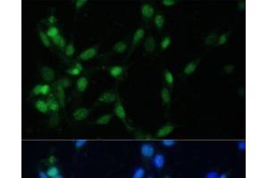 Immunofluorescence analysis of NIH-3T3 cells using MAD2L1 Polyclonal Antibody at dilution of 1:100 (40x lens).