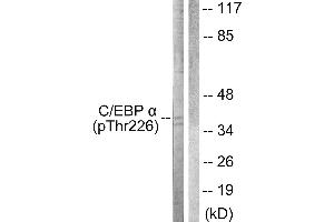 Western blot analysis of extracts from COS7 cells, treated with EGF (200ng/ml, 30mins), using C/EBP-α (Phospho-Thr226) antibody. (CEBPA Antikörper  (pThr226))