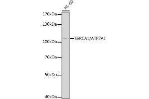 Western blot analysis of extracts of HL-60 cells, using SERC/SERC/ antibody (0104) at 1:1000 dilution. (ATP2A1/SERCA1 Antikörper  (AA 350-600))