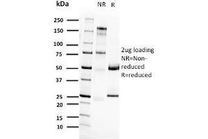 SDS-PAGE Analysis Purified RET Mouse Monoclonal Antibody (RET/2662). (Ret Proto-Oncogene Antikörper  (AA 702-848))