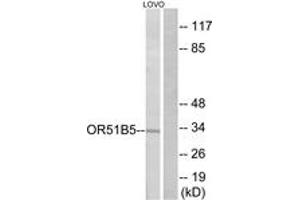Western blot analysis of extracts from LOVO cells, using OR51B5 Antibody. (OR51B5 Antikörper  (AA 200-249))