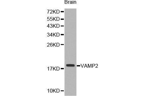 VAMP2 抗体  (AA 1-100)