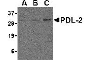 Western Blotting (WB) image for anti-Programmed Cell Death 1 Ligand 2 (PDCD1LG2) (Middle Region) antibody (ABIN1031035) (PDCD1LG2 Antikörper  (Middle Region))