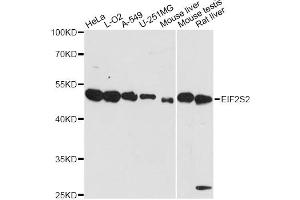 Western blot analysis of extracts of various cell lines, using EIF2S2 antibody.