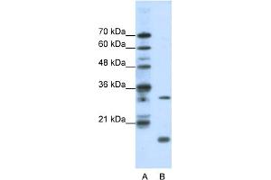 WB Suggested Anti-MAX Antibody Titration:  1.
