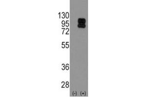 Western blot analysis of CD19 antibody and 293 cell lysate (2 ug/lane) either nontransfected (Lane 1) or transiently transfected with the CD19 gene (2).