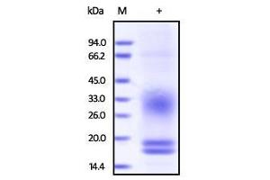 Cynomolgus CD3E & CD3D, His Tag & Flag Tag on SDS-PAGE under reducing (R) condition.