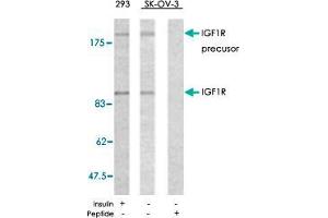 Western blot analysis of extracts from 293 and SK-OV-3 cells using IGF1R polyclonal antibody  . (IGF1R Antikörper)