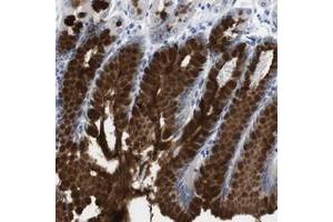 Immunohistochemical staining of human stomach with C1RL polyclonal antibody  shows strong cytoplasmic positivity in glandular cells. (C1RL Antikörper)