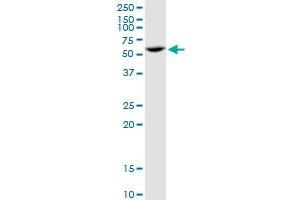 Western Blotting (WB) image for anti-Protein Phosphatase 2, Regulatory Subunit B' alpha (PPP2R5A) (AA 1-486) antibody (ABIN519125)