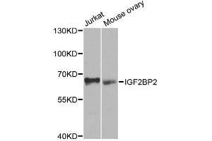 Western blot analysis of extracts of various cell lines, using IGF2BP2 antibody.
