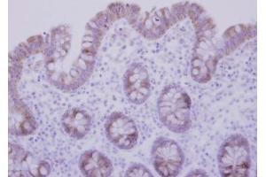IHC-P Image Immunohistochemical analysis of paraffin-embedded human normal colon, using CCDC83, antibody at 1:500 dilution. (CCDC83 Antikörper)