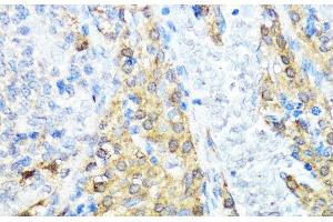 Immunohistochemistry of paraffin-embedded Rat ovary using NOD1 Polyclonal Antibody at dilution of 1:100 (40x lens). (NOD1 Antikörper)