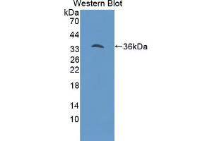 Western blot analysis of the recombinant protein. (Hepcidin Antikörper  (AA 29-82))