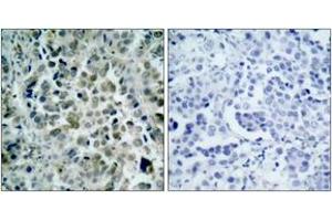 Immunohistochemistry (IHC) image for anti-Histone Deacetylase 8 (HDAC8) (AA 5-54) antibody (ABIN2888999) (HDAC8 Antikörper  (AA 5-54))