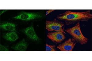 ICC/IF Image alpha Dystroglycan antibody detects alpha Dystroglycan protein at cytoplasm by immunofluorescent analysis.