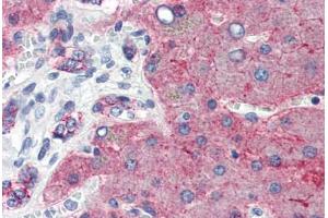 Human Liver (formalin-fixed, paraffin-embedded) stained with CLDN1 antibody ABIN457476 at 5 ug/ml followed by biotinylated goat anti-rabbit IgG secondary antibody ABIN481713, alkaline phosphatase-streptavidin and chromogen. (Claudin 1 Antikörper  (C-Term))