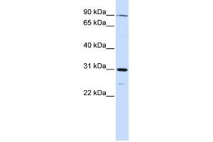 WB Suggested Anti-LONRF3 Antibody Titration:  0. (LONRF3 Antikörper  (N-Term))