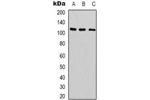 Western blot analysis of SUPT16H expression in Hela (A), A549 (B), Jurkat (C) whole cell lysates.