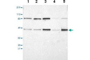 Western blot analysis of Lane 1: RT-4, Lane 2: U-251 MG, Lane 3: A-431, Lane 4: Liver, Lane 5: Tonsil with IRF9 polyclonal antibody at 1:250-1:500 dilution. (IRF9 Antikörper)